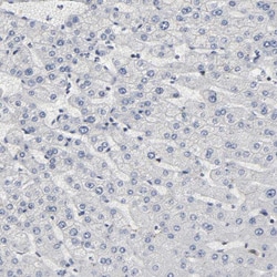 Invitrogen AHNAK2 Polyclonal Antibody 100 &mu;L; Unconjugated:Antibodies,