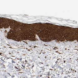 Invitrogen AHNAK2 Polyclonal Antibody 100 &mu;L; Unconjugated:Antibodies,