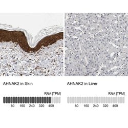 Invitrogen AHNAK2 Polyclonal Antibody 100 &mu;L; Unconjugated:Antibodies,