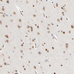 Invitrogen NOVA1 Polyclonal Antibody 100 &mu;L | Buy Online | Invitrogen&trade; | Fisher Scientific