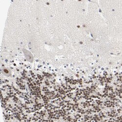 Invitrogen SALL2 Polyclonal Antibody 100 &mu;L; Unconjugated:Antibodies,
