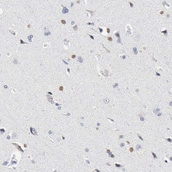 Invitrogen SALL2 Polyclonal Antibody 100 &mu;L; Unconjugated:Antibodies,