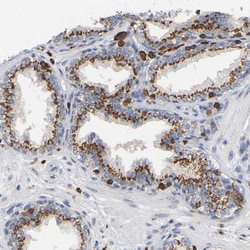 Invitrogen Calpain 10 Polyclonal Antibody 100 &mu;L; Unconjugated:Antibodies,