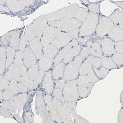 Invitrogen Calpain 10 Polyclonal Antibody 100 &mu;L; Unconjugated:Antibodies,
