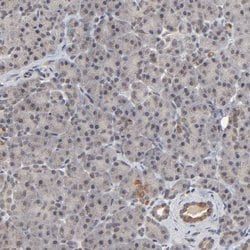 Invitrogen AUH Polyclonal Antibody 100 &mu;L; Unconjugated:Antibodies,