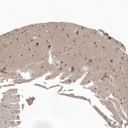 Invitrogen ZNF473 Polyclonal Antibody 100 &mu;L; Unconjugated:Antibodies,