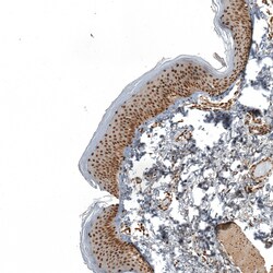 Invitrogen ZNF473 Polyclonal Antibody 100 &mu;L; Unconjugated:Antibodies,