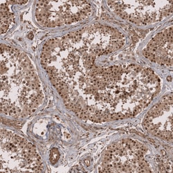 Invitrogen ZNF473 Polyclonal Antibody 100 &mu;L; Unconjugated:Antibodies,