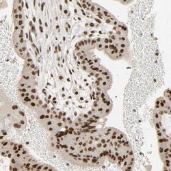 Invitrogen NCOA6 Polyclonal Antibody 100 &mu;L | Buy Online | Invitrogen&trade; | Fisher Scientific