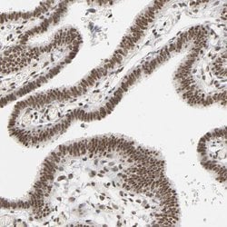 Invitrogen NCOA6 Polyclonal Antibody 100 &mu;L | Buy Online | Invitrogen&trade; | Fisher Scientific