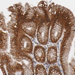 Invitrogen ASB6 Polyclonal Antibody 100 &mu;L | Buy Online | Invitrogen&trade; | Fisher Scientific