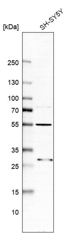 Invitrogen ASB6 Polyclonal Antibody 100 &mu;L | Buy Online | Invitrogen&trade; | Fisher Scientific