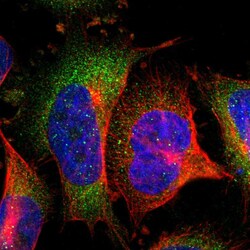 Invitrogen SOCS7 Polyclonal Antibody 100 &mu;L; Unconjugated:Antibodies,