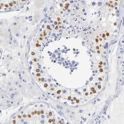 Invitrogen SOCS7 Polyclonal Antibody 100 &mu;L; Unconjugated:Antibodies,