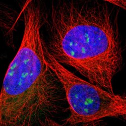 Invitrogen DDX10 Polyclonal Antibody 100 &mu;L; Unconjugated:Antibodies,
