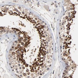 Invitrogen DDX10 Polyclonal Antibody 100 &mu;L; Unconjugated:Antibodies,