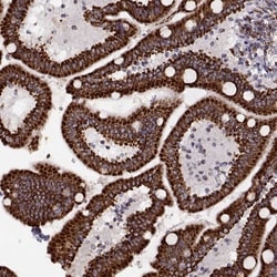 Invitrogen Arylsulfatase D Polyclonal Antibody 100 &mu;L; Unconjugated:Antibodies,
