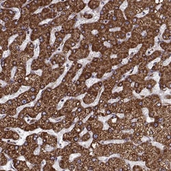 Invitrogen Arylsulfatase D Polyclonal Antibody 100 &mu;L; Unconjugated:Antibodies,