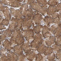 Invitrogen TAPP2 Polyclonal Antibody 100 &mu;L; Unconjugated:Antibodies,