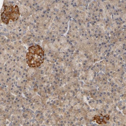Invitrogen SCAP Polyclonal Antibody 100 &mu;L; Unconjugated:Antibodies,