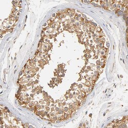 Invitrogen SCAP Polyclonal Antibody 100 &mu;L; Unconjugated:Antibodies,