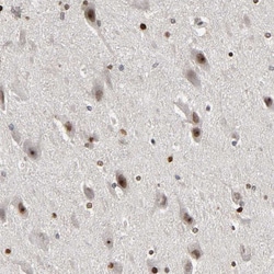 Invitrogen CPN2 Polyclonal Antibody 100 &mu;L; Unconjugated:Antibodies,