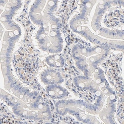 Invitrogen MEF2B Polyclonal Antibody 100 &mu;L; Unconjugated:Antibodies,