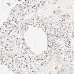 Invitrogen MEF2B Polyclonal Antibody 100 &mu;L; Unconjugated:Antibodies,