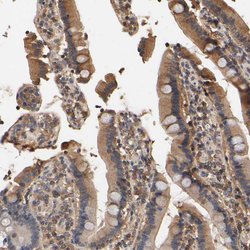 Invitrogen ARHGEF7 Polyclonal Antibody 100 &mu;L; Unconjugated:Antibodies,