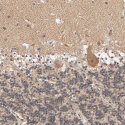 Invitrogen ARHGEF7 Polyclonal Antibody 100 &mu;L; Unconjugated:Antibodies,