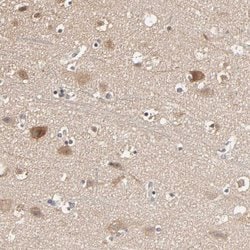 Invitrogen ARHGEF7 Polyclonal Antibody 100 &mu;L; Unconjugated:Antibodies,