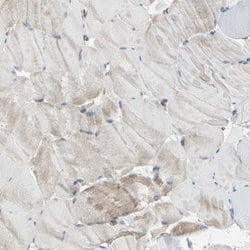 Invitrogen Filamin B Polyclonal Antibody 100 &mu;L; Unconjugated:Antibodies,