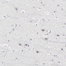Invitrogen PDLIM3 Polyclonal Antibody 100 &mu;L; Unconjugated:Antibodies,