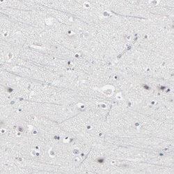 Invitrogen PDLIM3 Polyclonal Antibody 100 &mu;L; Unconjugated:Antibodies,