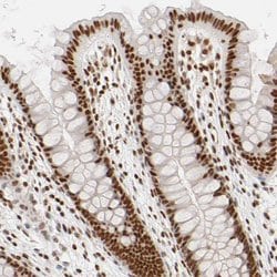 Invitrogen ILKAP Polyclonal Antibody 100 μL; Unconjugated:Antibodies,