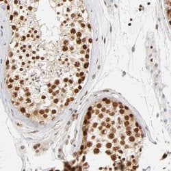 Invitrogen ILKAP Polyclonal Antibody 100 μL; Unconjugated:Antibodies,
