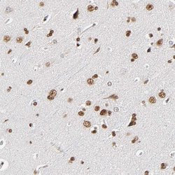 Invitrogen ILKAP Polyclonal Antibody 100 μL; Unconjugated:Antibodies,