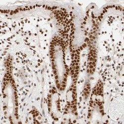 Invitrogen ILKAP Polyclonal Antibody 100 μL; Unconjugated:Antibodies,
