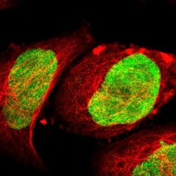 Invitrogen ILKAP Polyclonal Antibody 100 μL; Unconjugated:Antibodies,