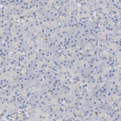 Invitrogen UCKL1 Polyclonal Antibody 100 &mu;L; Unconjugated:Antibodies,