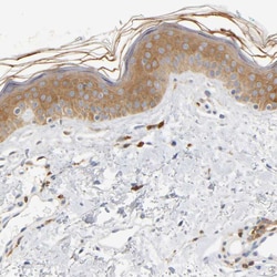 Invitrogen UCKL1 Polyclonal Antibody 100 &mu;L; Unconjugated:Antibodies,