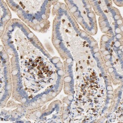 Invitrogen UCKL1 Polyclonal Antibody 100 &mu;L; Unconjugated:Antibodies,