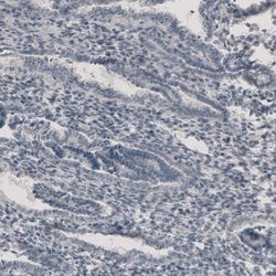 Invitrogen CT83 Polyclonal Antibody 100 &mu;L; Unconjugated:Antibodies,