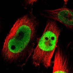 Invitrogen AKAP8 Polyclonal Antibody 100 &mu;L; Unconjugated:Antibodies,
