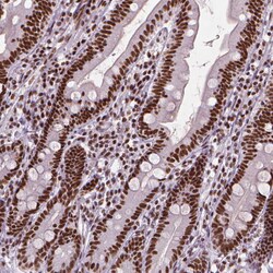 Invitrogen AKAP8 Polyclonal Antibody 100 &mu;L; Unconjugated:Antibodies,