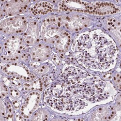 Invitrogen AKAP8 Polyclonal Antibody 100 &mu;L; Unconjugated:Antibodies,