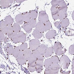 Invitrogen AKAP8 Polyclonal Antibody 100 &mu;L; Unconjugated:Antibodies,