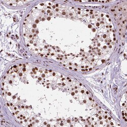 Invitrogen AKAP8 Polyclonal Antibody 100 &mu;L; Unconjugated:Antibodies,