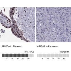 Invitrogen DRIL1 Polyclonal Antibody 100 &mu;L; Unconjugated:Antibodies,
