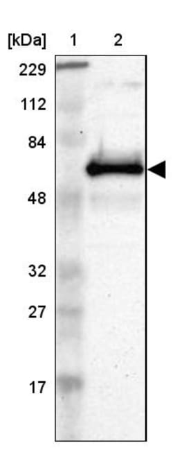 Invitrogen ETV3 Polyclonal Antibody 100 &mu;L; Unconjugated:Antikroppar